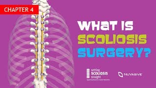 Ch. 4 - What is Scoliosis Surgery?