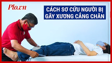 Sơ cứu cho người bị gãy xương cẳng chân và những điều cần lưu ý - Sống vui khỏe - PLO