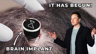 Neuralink, Elon Musk company's new invention