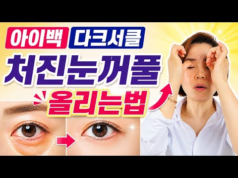 아이백 다크서클 처진 눈꺼풀 올리기 핵심 눈밑처짐 복구 셀프마사지 