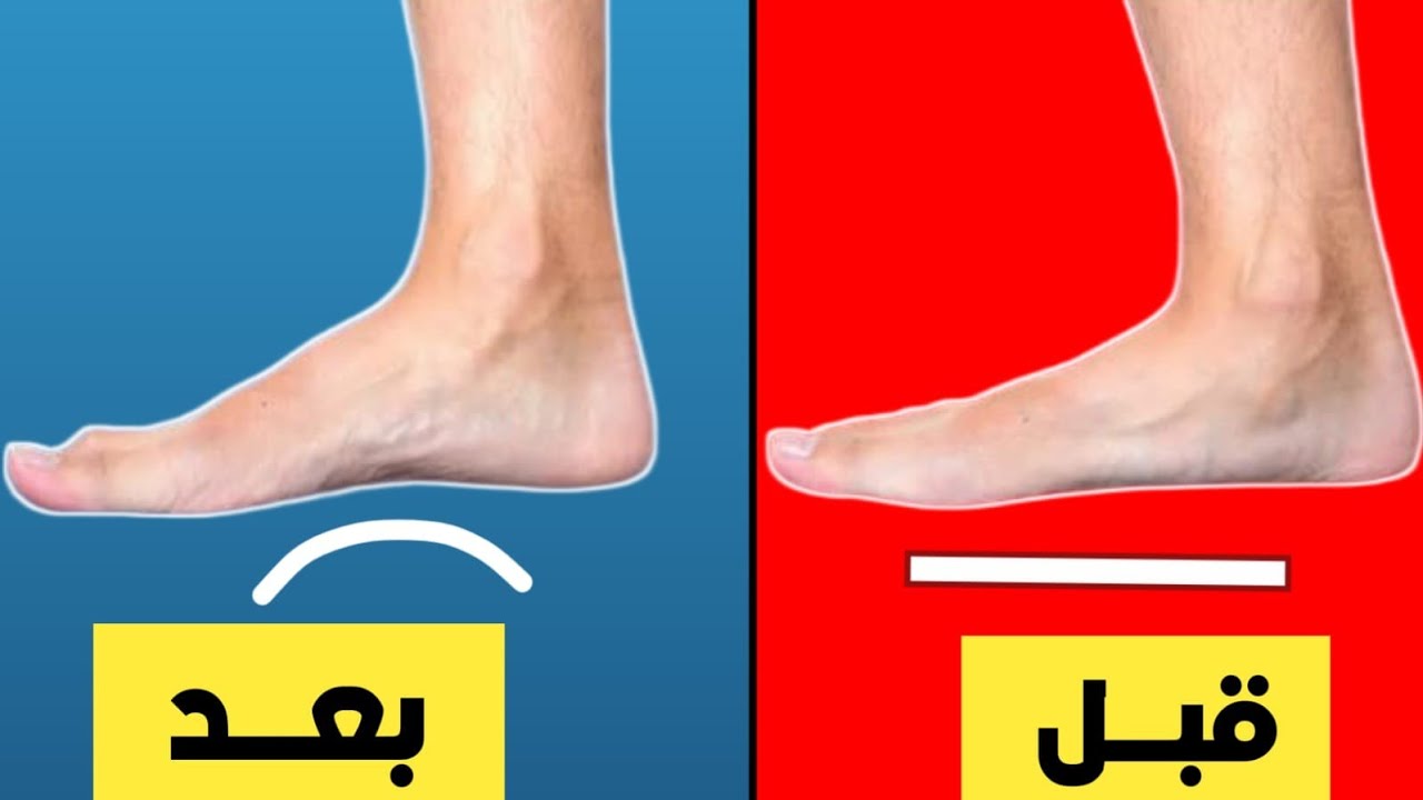 علاج الفلات فوت بتمارين منزلية: تمارين مجربة لتقوية قوس القدم وتحسين وضعية الجسم