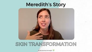 Skin Transformation Testimonial - Meredith's Story | Dr. Ana-Maria Temple, Holistic Pediatrician