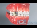 Dental Development (45 Degree Angle View)