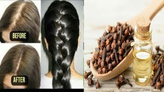 الإسبراي السحري الطبيعي لعلاج تساقط الشعر في اسبوع بالمنزل How to stop hair fall in Just 7 Days