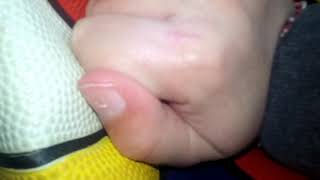 Notify Host Runs To Deflating A Ball