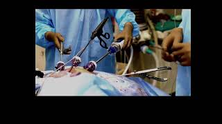 Endometriosis Surgery- Bowel Repair for a Fresh Large Injury with a DISCOID Excision