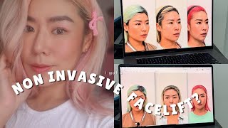 Review: I tried Ultherapy at Halley Medical Aesthetics!