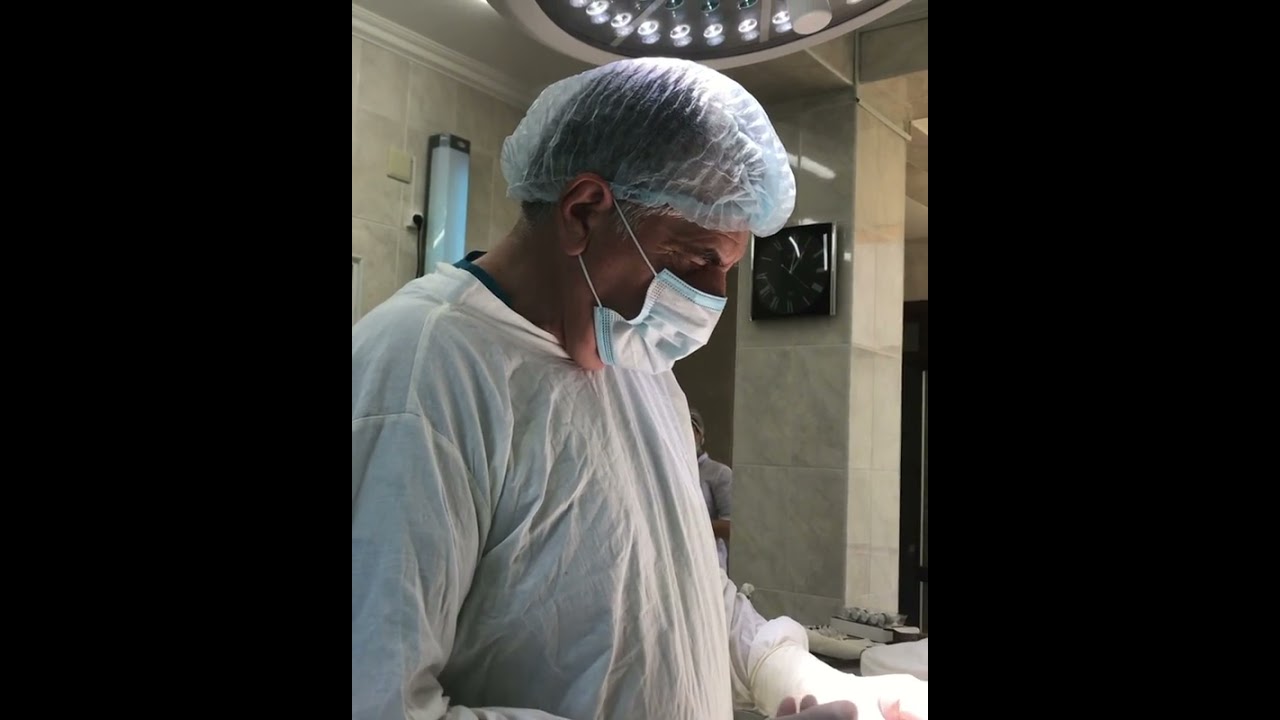 Киста Урахуса