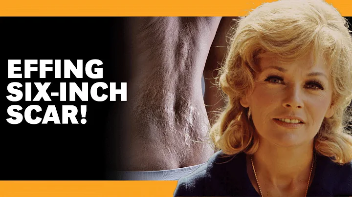 These Tragedies Destroyed Joanna Moore After She L...