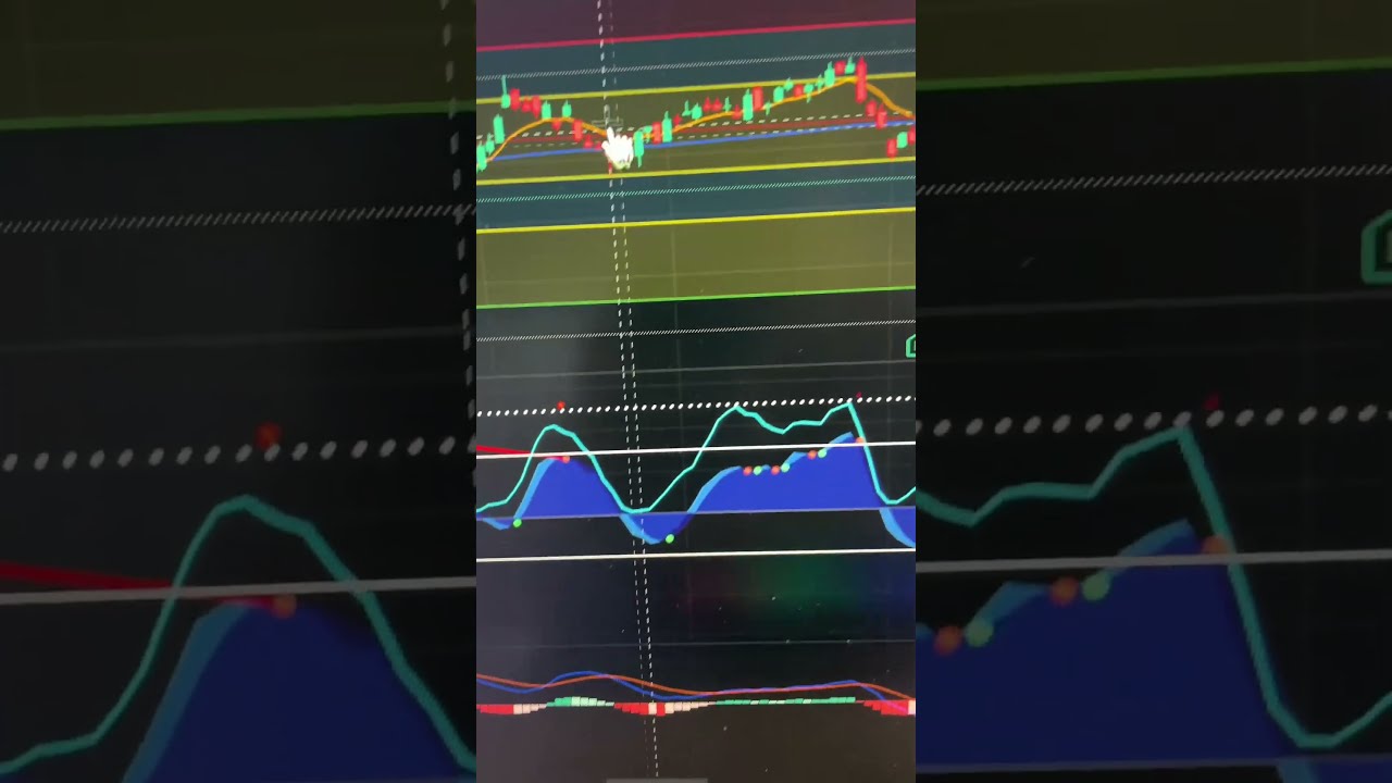 7 Stocks To Watch Right Now Top Trading Investing Picks