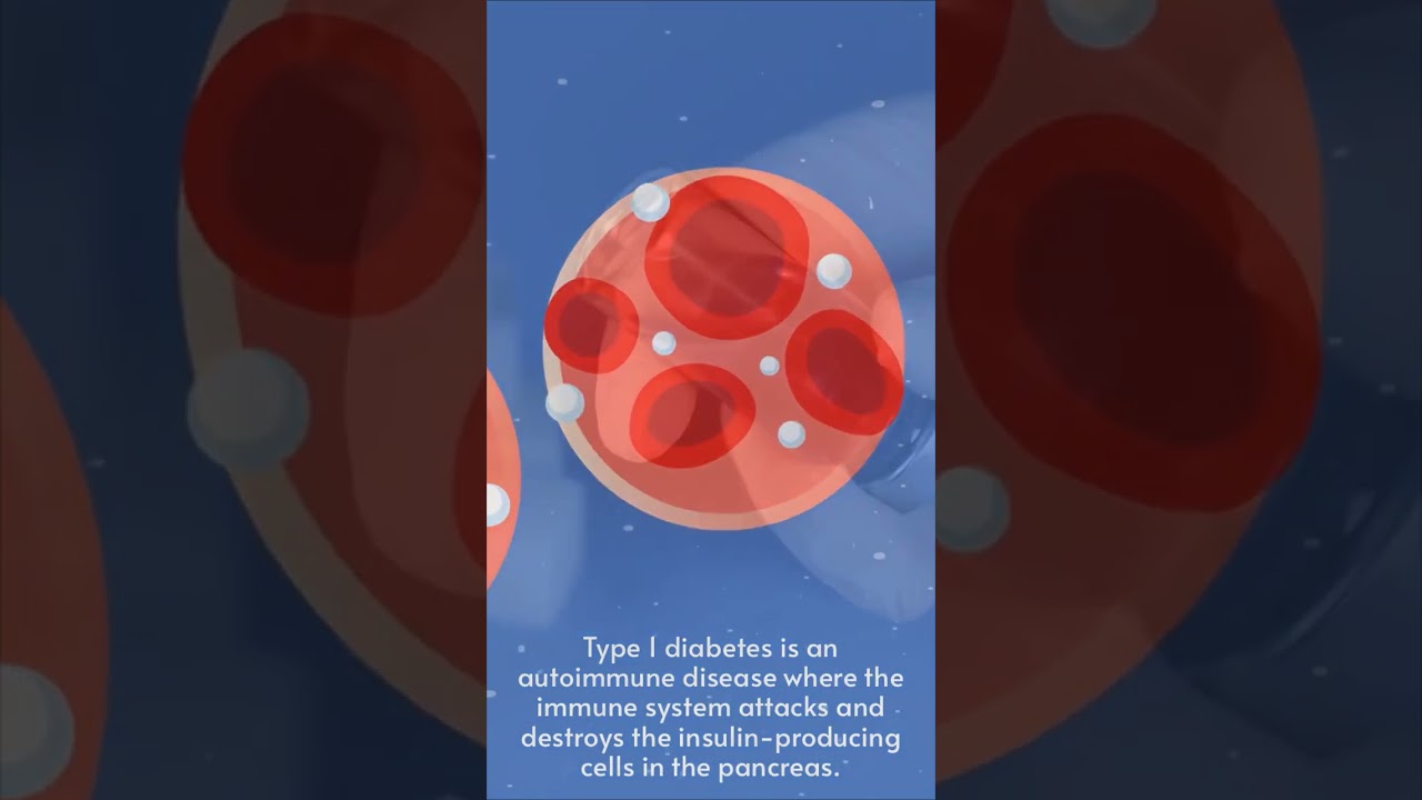 Understanding the Causes of Diabetes | Health Tips