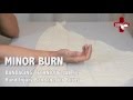 Hand Injury Bandage for Burns | Singapore Emergency Responder Academy, First Aid and CPR Training