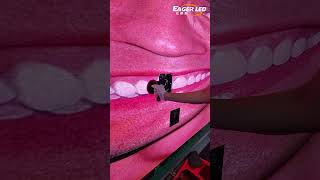 Help Fix Cristiano Ronaldos Pearly Whites.