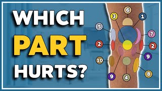 My knee hurts here! 10 typical pain spots and what they mean