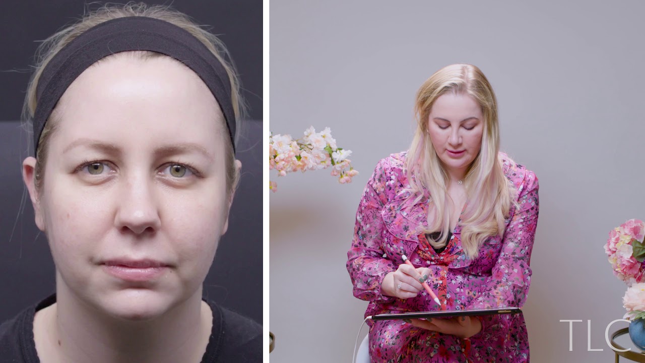 How Dermal Fillers Can Help You Look Less Tired or Sad