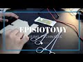 Learn Episiotomy Stitching