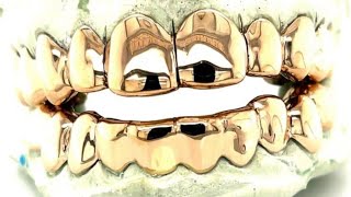 How to tighten grillz at home by #FredTheJeweler. screenshot 3