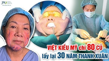 Bác sĩ Tú Dung Căng da mặt SMAS PRO giúp Việt kiều Mỹ U70 lấy lại 30 NĂM thanh xuân