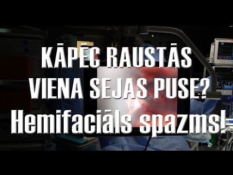 Video: Kāpēc rodas pannus?