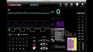 ECG Simulator - EKG Rhythm Simulator