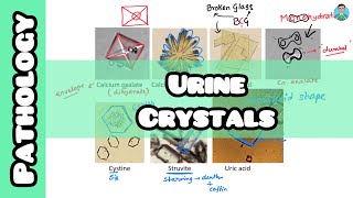Urine Crystals explained #usmle #firstaid for #inicet #neetpg #nclex (with #mnemonics) Urine Crystals Kidney Stones With A Mnemonic