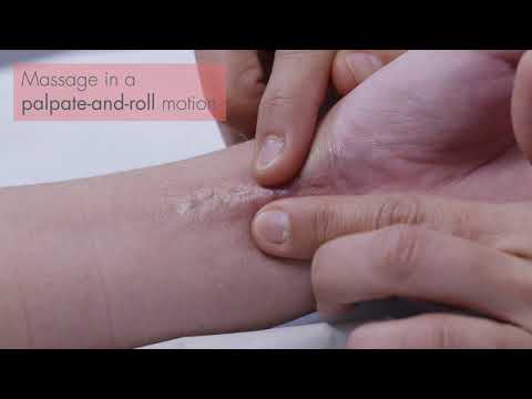 Video: Hoe het litteken sy litteken FMA gekry?