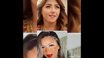 الفنانه ساره سلامه تظهر بعد عمل يه تجميل فاشله بشكل هيصدمك 