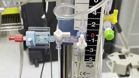 Intracranial Pressure Monitoring: INTEGRA-EVD Explained