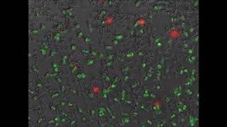 Mechanisms involved in the triggering of neutrophil extracellular traps (NETs) by Candida glabrata