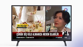 Çürük Diş Kilo Almanıza Neden Olabilir Dr. Hatice Ağan