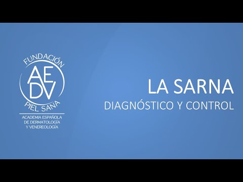 Sarna: Síntomas, tratamiento y complicaciones - Policlínica