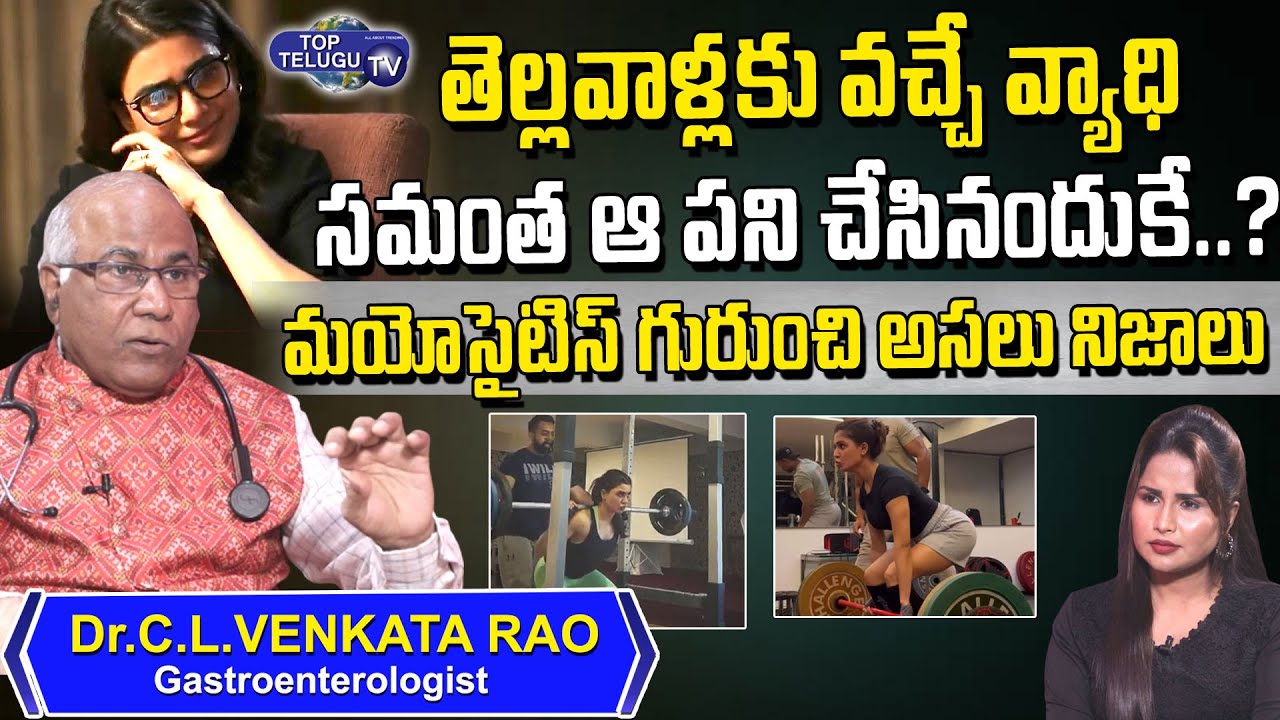 Dr. CL Venkat Rao About Samantha Myositis Disease | Dr Cl Venkat Rao ...