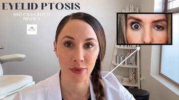 Lid Ptosis from Botox: What it is & 4 ways to prevent it from happening 💉