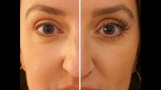 How to Order Latisse from SkinSolutions.MD