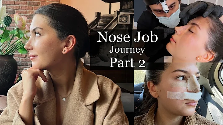 Nose Job/ Rhinoplasty in Istanbul Part 2 | Surgery...