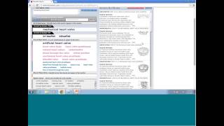 LexisNexis TotalPatent Semantic Search: Keep Your Search Out of the Black Box