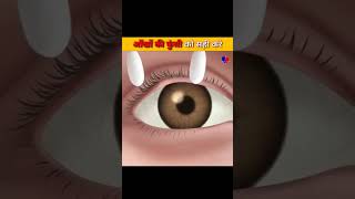Amazing Facts Eyes Pimples!! 😱😱 #shorts #science