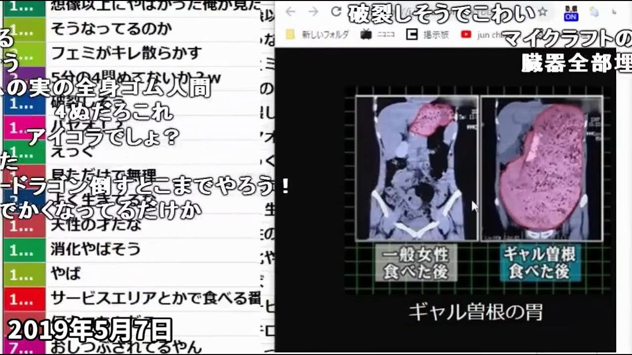 ギャル 曽根 レントゲン