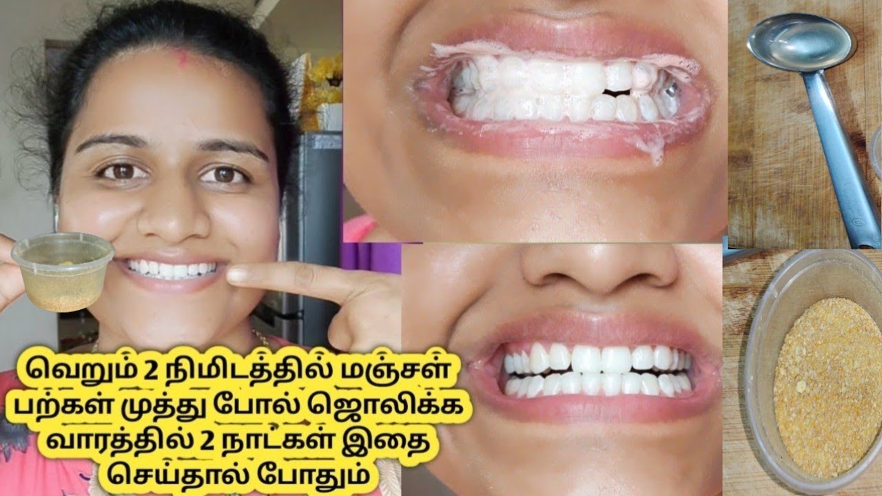 பற்களில் உள்ள மஞ்சள் கறையை போக்க/Teeth Whitening at home in tamil/How