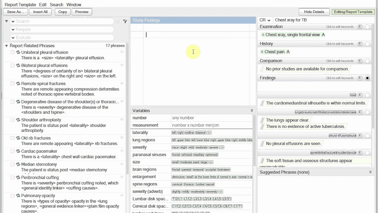Finding and customizing report templates - YouTube