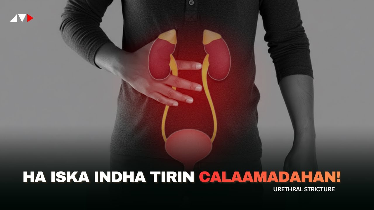 Dhibaato Qarsoon oo Ragga ku Badan! Dumarkana kudhicikara | Urethral Stricture