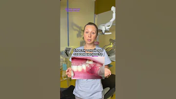 Чем опасна гнойная шишка на десне❓🤯