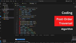 Post order traversal of Binary Tree | python |