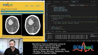 Famous Exploring Image Feature Detection: Fast, Harris, and Shi-Tomasi Algorithms in Action Wealth