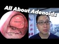 Adenoids and Adenoidectomy: what are they, when do we remove them, what is the surgery like