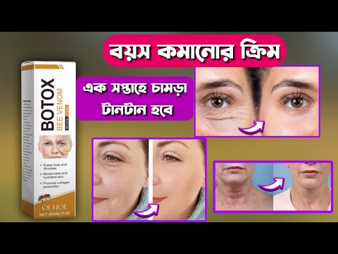 Botox bee Venom wrinkles Cream Review | use | benefits | side effects