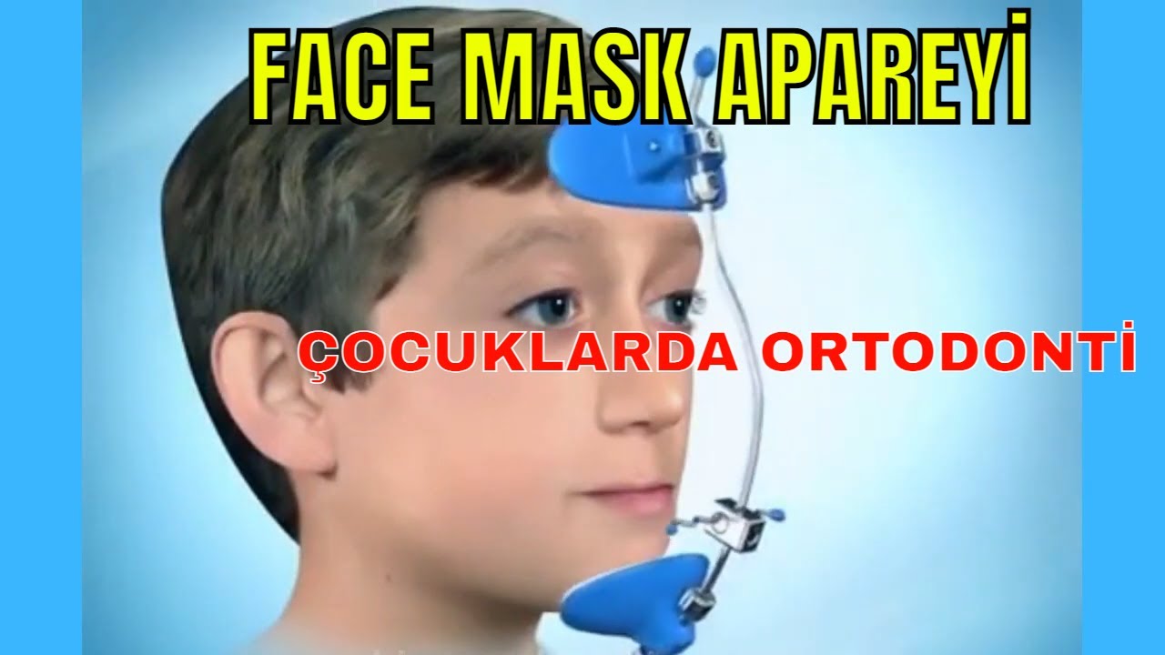 Face mask apereyi ( Çocuklarda Ortodonti )