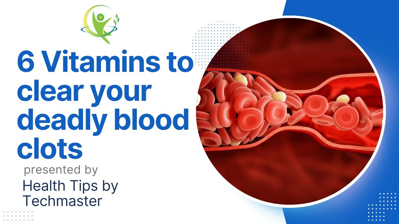 Vitamins to clear your (deadly blood clots) YouTube