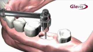 MEISINGER - ApEX Control