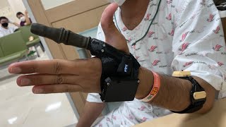 Mand.ro One Finger Mark 7 - Simple User Test (2023.08.17)